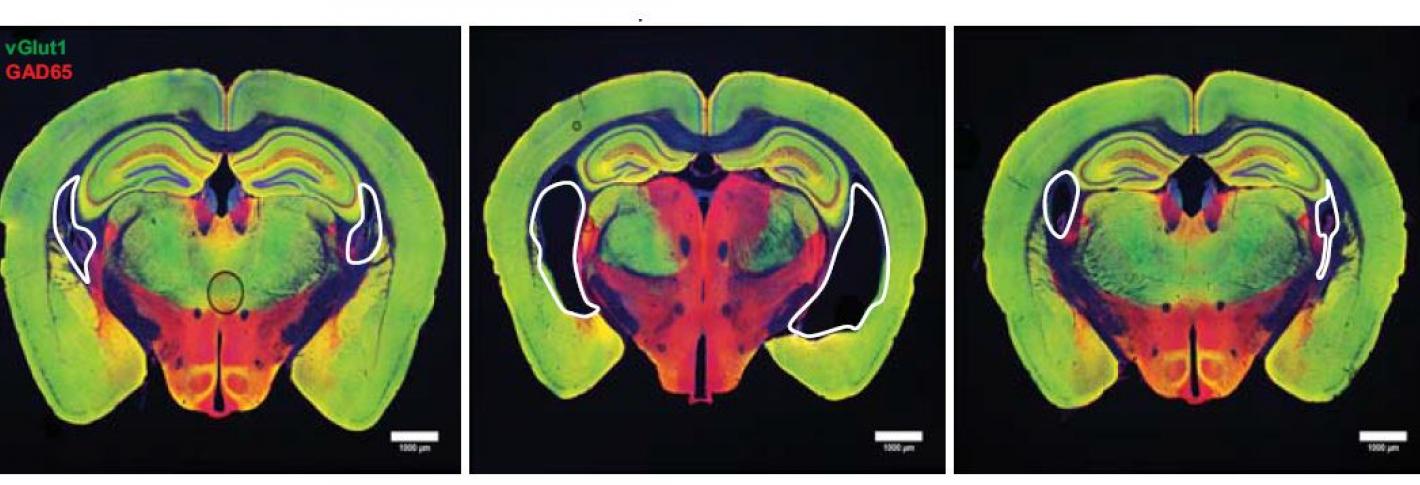 Alzheimer's mouse model brain showing enlarged ventricles