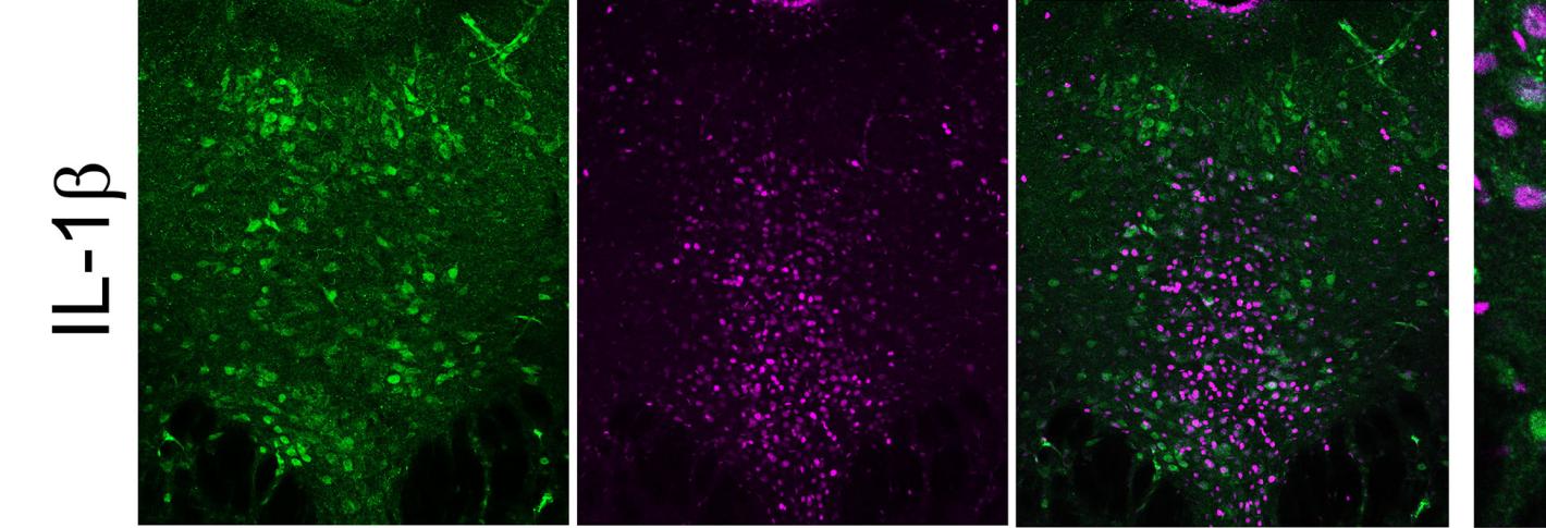 A 4 by 2 array of panels shows neurons in a brain section. Green "Myc" labeling indicates the presence of a receptor. Magenta "fos" labeling indicates neural activity. There is more magenta on the bottom row, which is labeled "IL-1B"