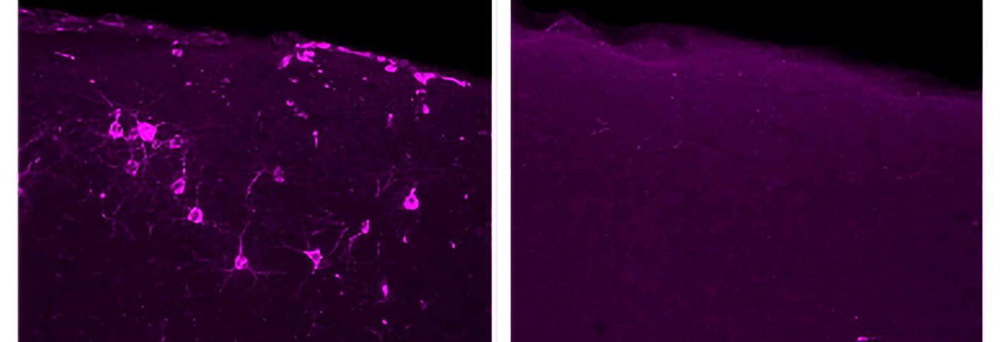 Two panels show cells with magenta staining on the left and a broader field of magenta with now specific cells visible on the right