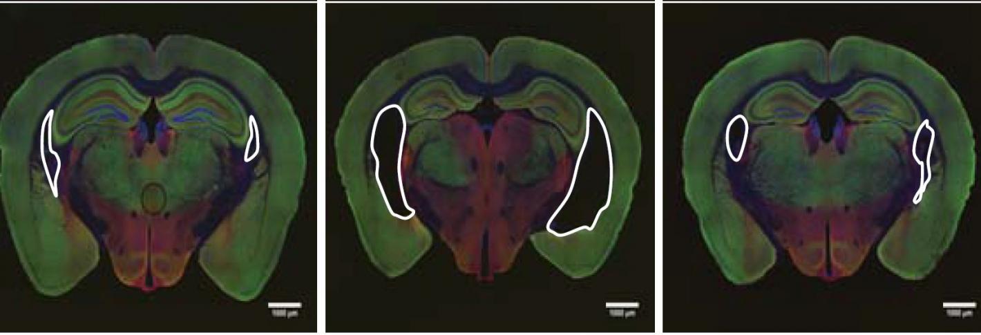 Three mouse brains in a row. White outlines show ventricles, or dark open spaces within