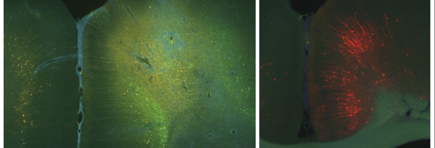 Two black panels on a white background show sections of brain. One glows with neurons colored green. The other panel glows with neurons colored red.