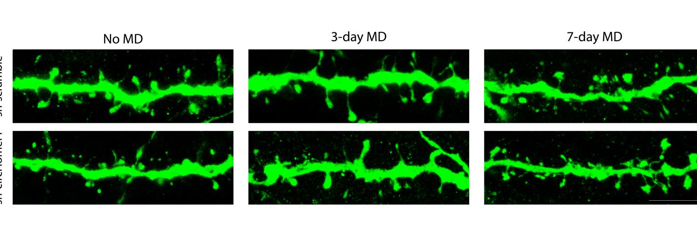 An array of six panels shows different views of a long, thin, spiny structure that closely resembles a bumpy twig. Each is stained bright green and the degree of bumpiness varies along each one.