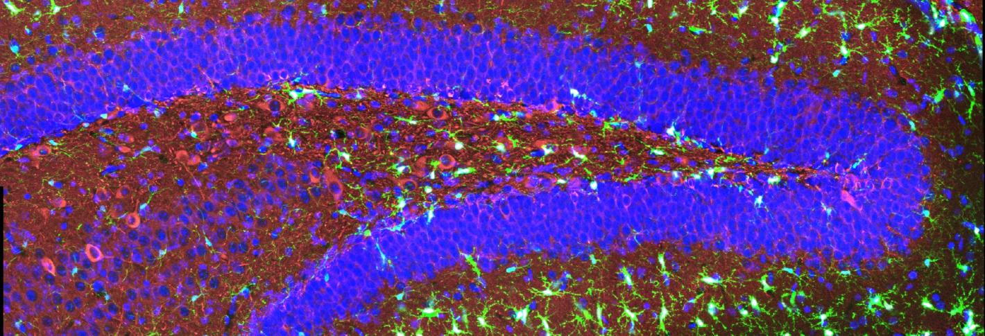 A colorfully stained section of a mouse hippocampus features scores of brightly glowing spiny-looking cells scattered throghout layers of tissue stained in blue and red