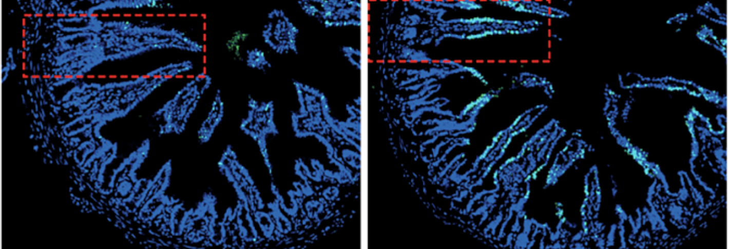 Four panels in a 2x2 array show a segment of intestine cross-sectioned in a deep blue. The left side shows when there is no bacteria and no cytokine response. On the right side there is bacteria and some of the tissue glows white. The bottom row of panels shows those areas zoomed in.