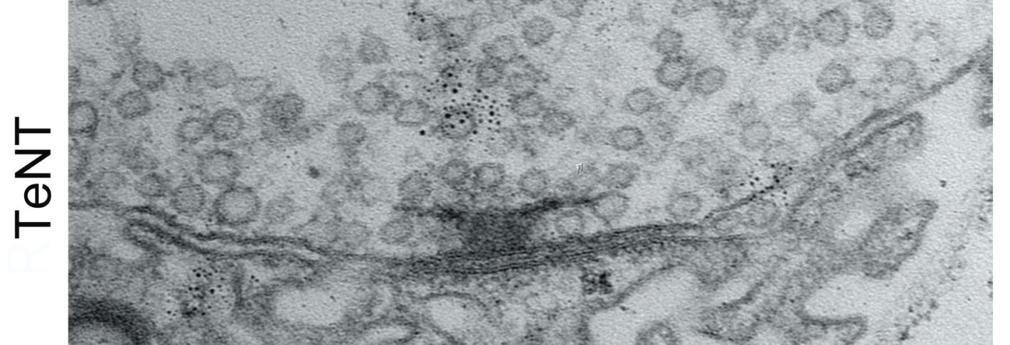 Two stacked electron microscope images show a synapse. Above a small, river-like gap is a dark T shape among many tiny bubble-like circles. In the bottom image the T shape is much bigger than in the upper image.