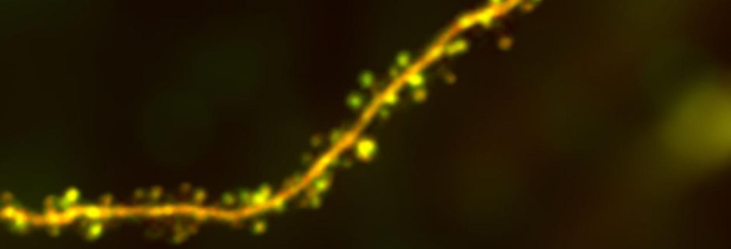 A dendrite lit up yellow-green snakes from the lower left to the upper right