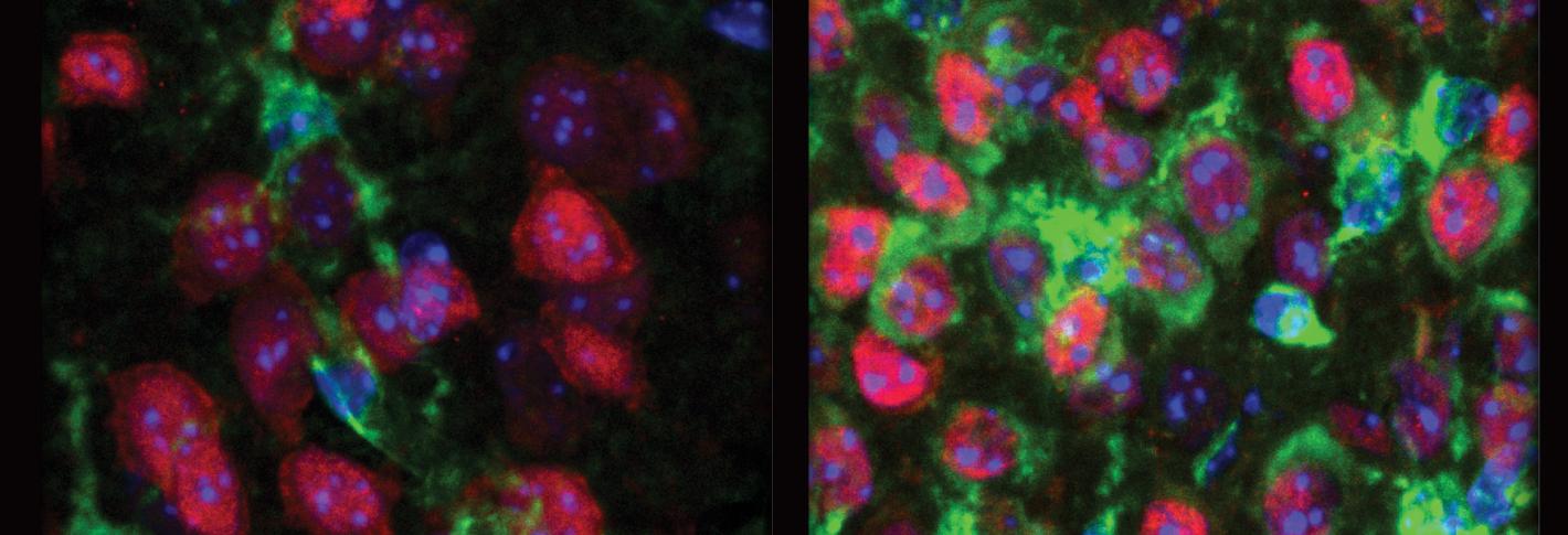 Two side by side panels compare neurons stained in red blue and green