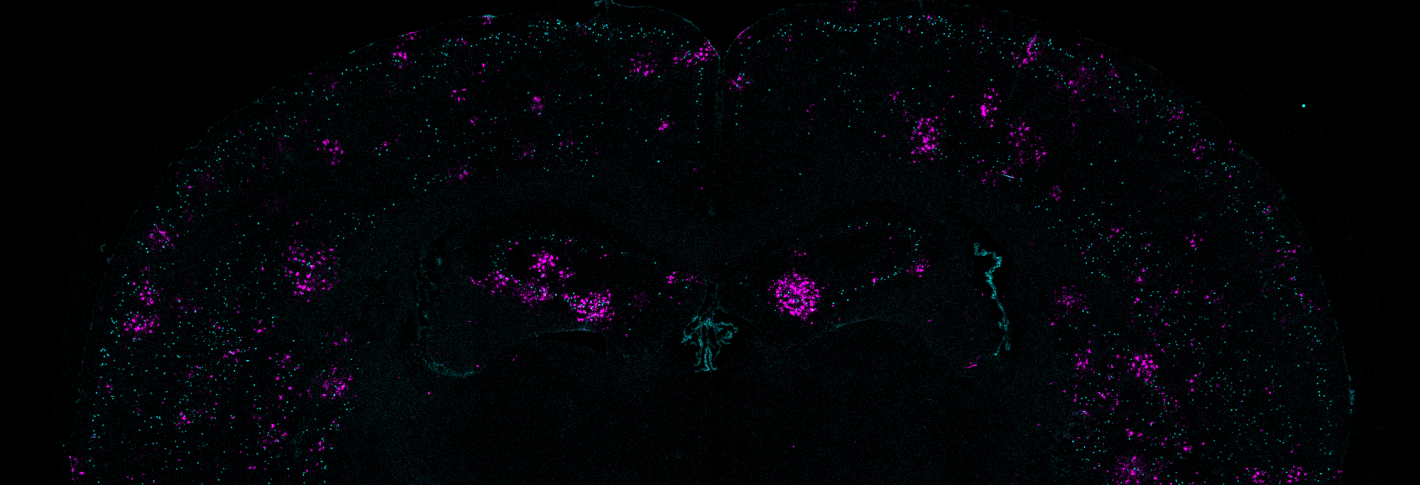 On a black background in the curvy M-like shape of a mouse brain cross section, many patches of tiny teal and purple dots appear