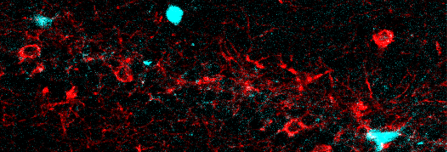 A stripe of red-colored neurons is accompanied by a few neurons in a contrasting cyan color