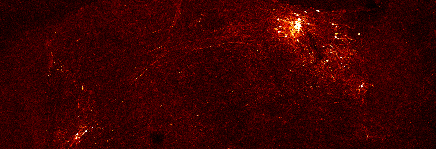Isloated clusters of neurons glow orange-yellow amid a dark background