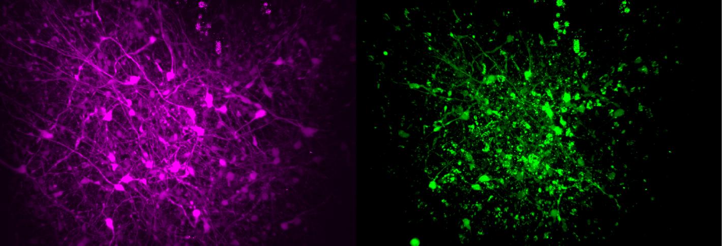 Three views of an organoid cell culture show the constiuent cells of the vaguely round, tangled mass of cells.  In the different views the cells are highlighted in different colors such as magenta and green.