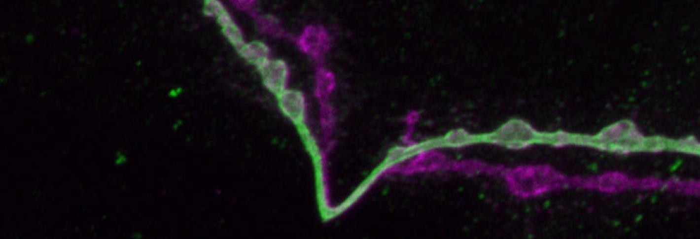 Over a black background two neural axons extend through the frame like lumpy check marks. One is light green with noticable darker green splotches within its lumps. The other is magenta and has no dark green splotches.