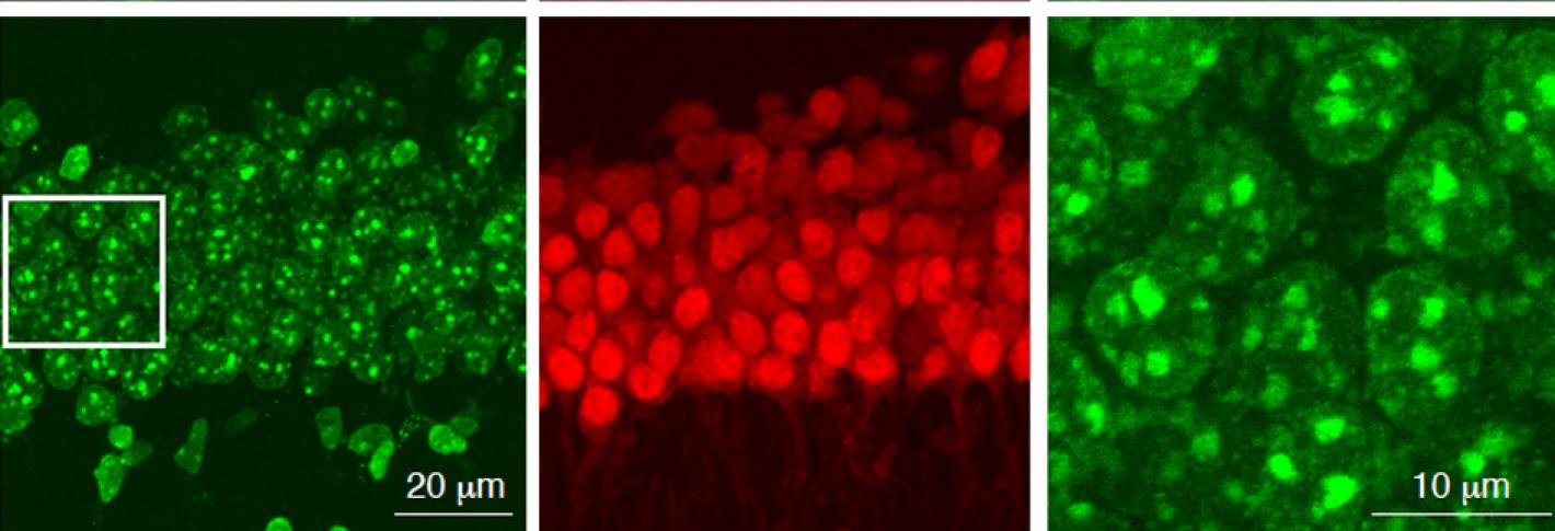 A six panel grid showing neurons stained red or green