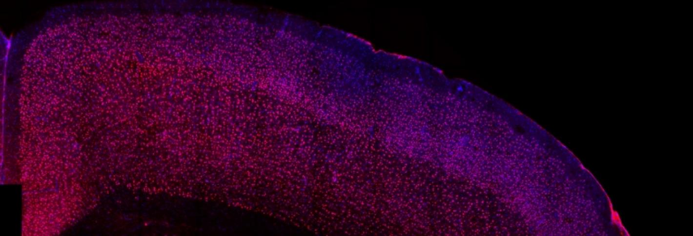 n this image, an irregularity in the somatosensory cortex, called a “patch,” can be seen as a cluster of blue in the brain of a mouse born to a mother that experienced Th17 immune activation during pregnancy.