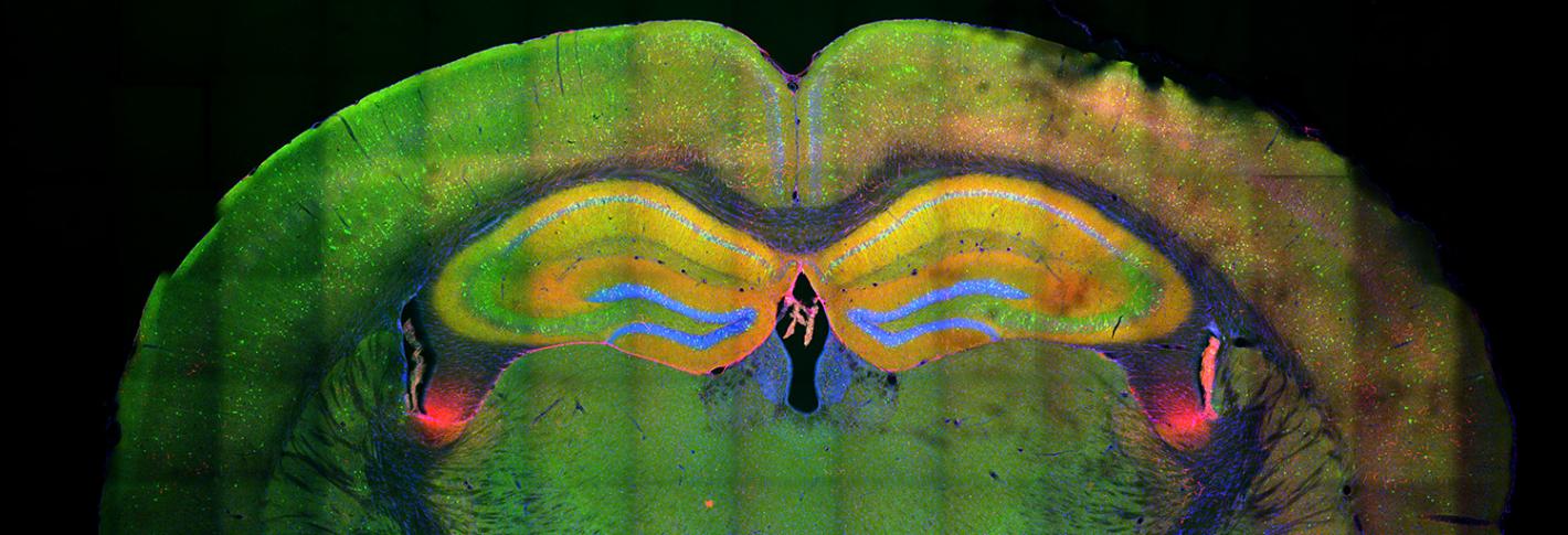 A colorful cross section of a mouse brain