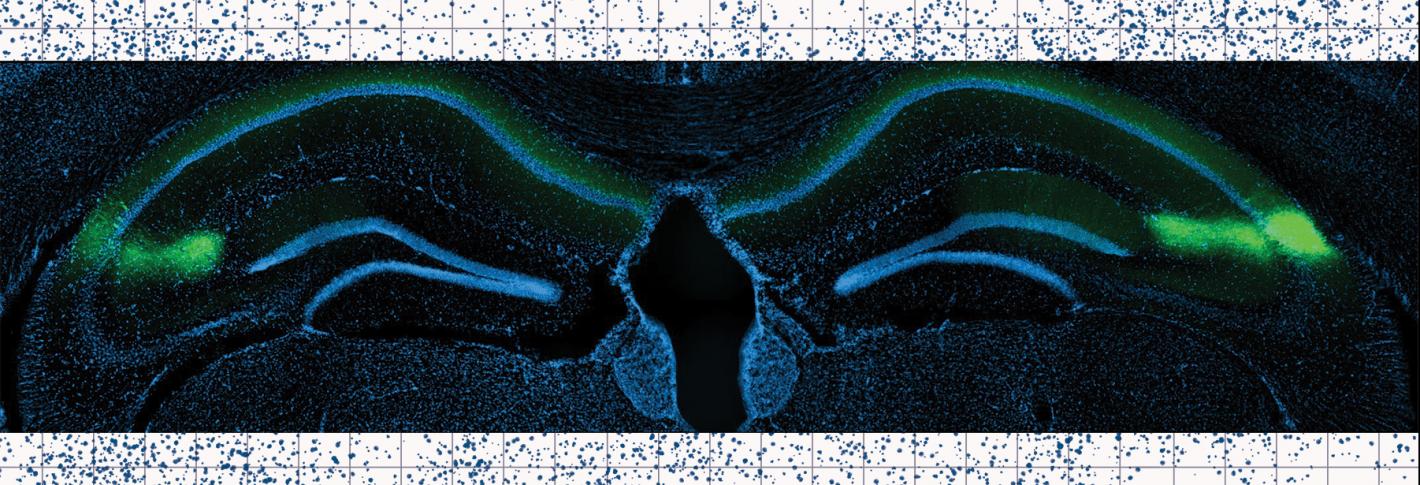A blusih tinted image shows fluorescently labeled mouse hippocampus tissue supreposed over a sheet of graph paper with patterns of blue dots