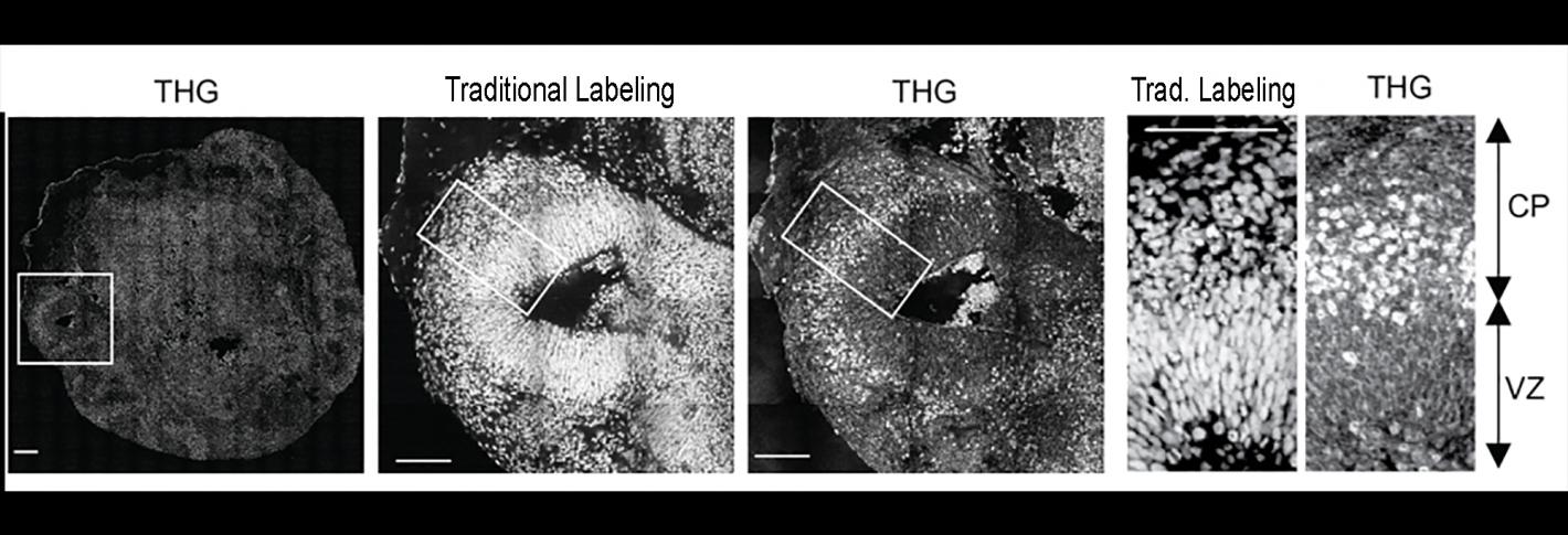 A horizontal strip of five panels shows successive zooming in on a section of an organoid. In each level of zoom traditional staining is compared with THG imaging.
