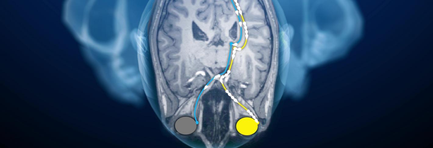 A cartoon of a man seen from overhead shows his brain with two eyes, yellow or green, sending flashes of input to the back of the brain