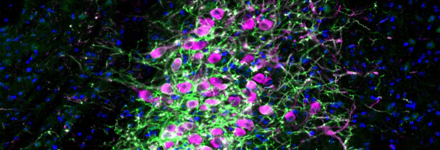 magenta cells with green extensions appear over a black background