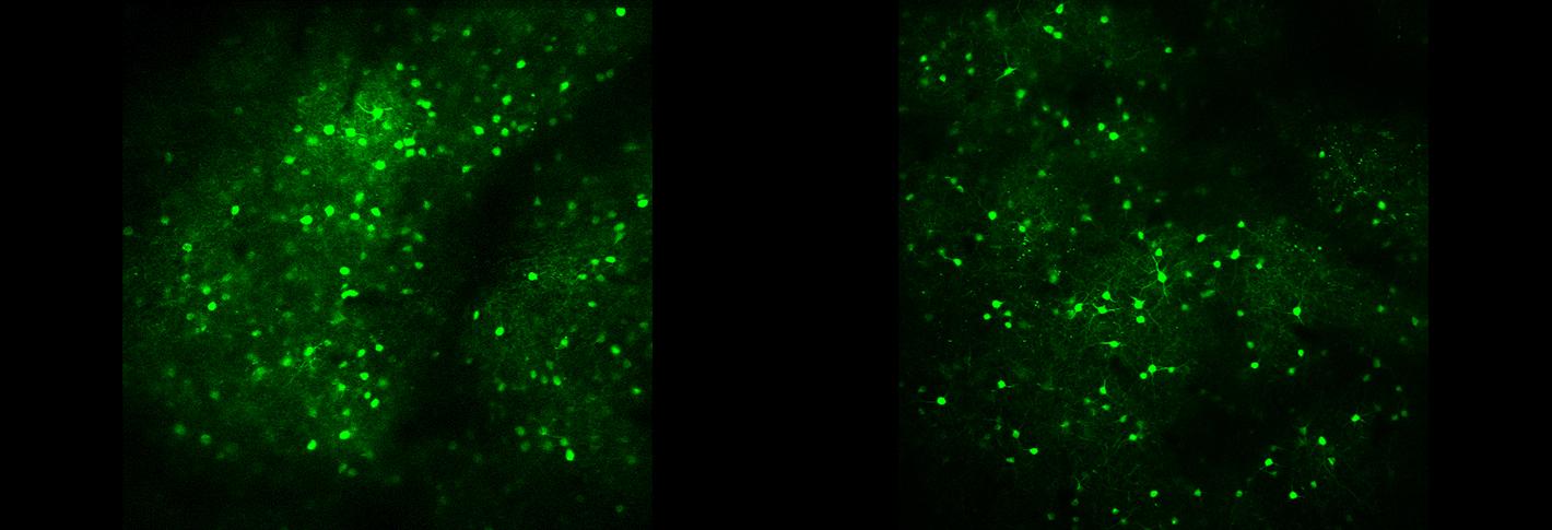 Over a black background, two amorphous fields of green stained neurons are separated by a black stripe