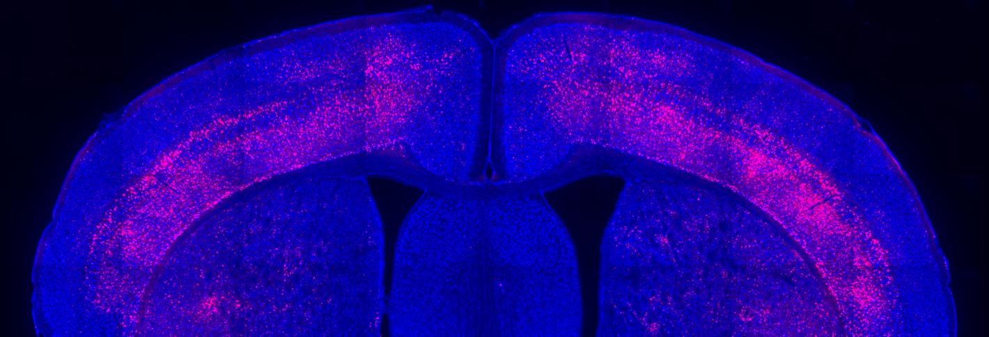 A cross-section of a mouse's brain is stained royal blue. Around the outer edge along the top there are many bright pink spots.