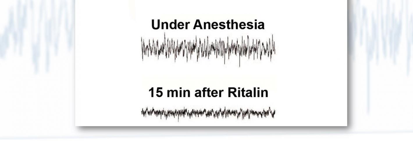 A slide shows EEG waves of a rat while awake, anesthetized and then reanimated with Ritalin