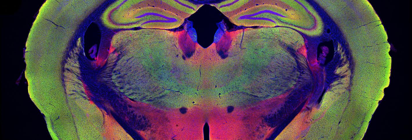 Color image of brain slice