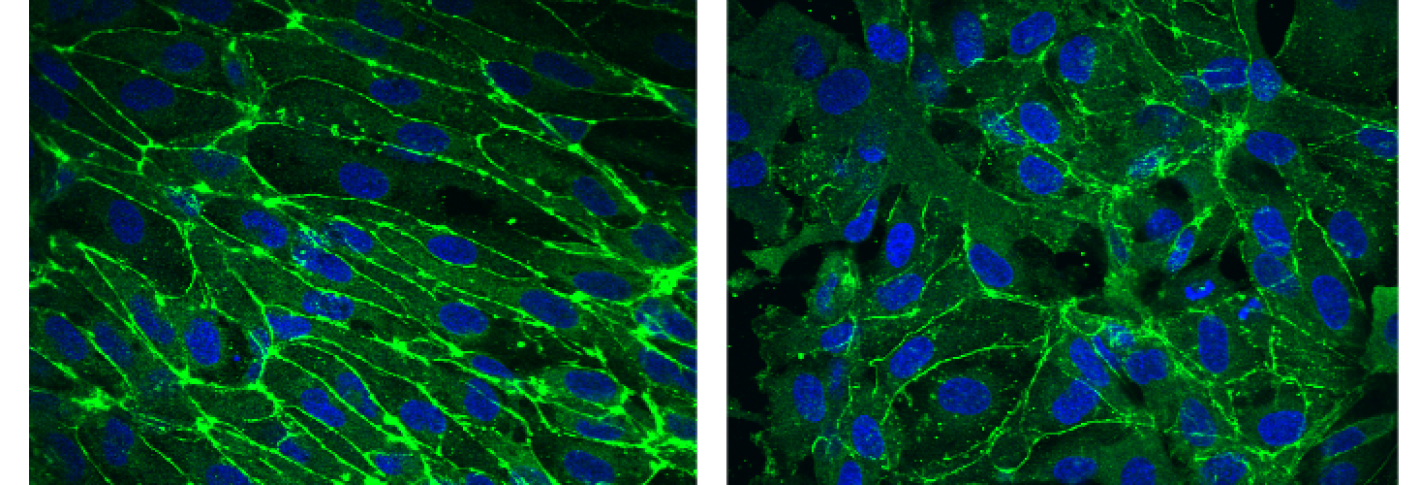 Two panels show blue cells surrounded by thin green outlines. The outlines are much more consistent and prevalent in the image on the left, which is labeled as the wild type, than on the right which is labeled Rett syndrome.