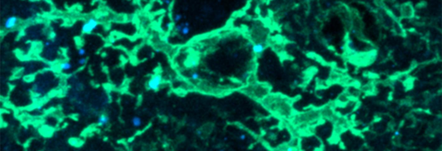 A sprawling, spidery green astrocyte sits next to a long bluish stripe