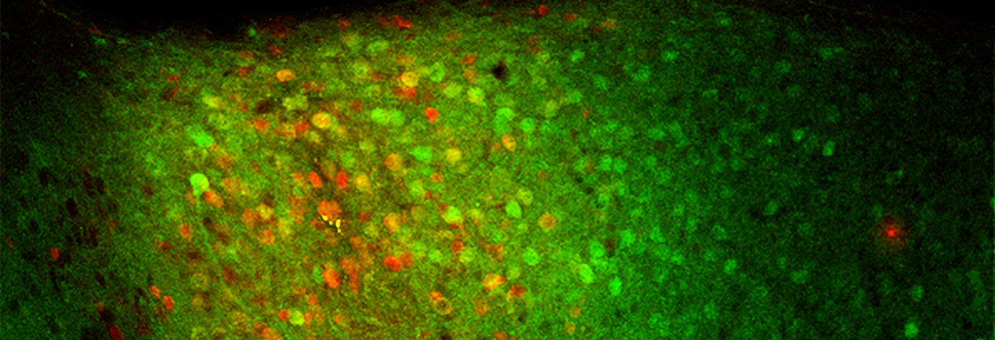 An area of brain tissue mostly glows green but has a red patch in the middle
