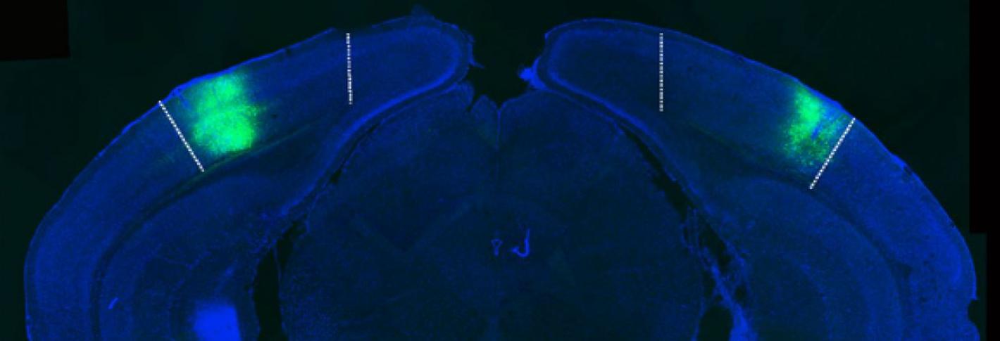 A blue coronal mouse brain section shows green highlighting in the visual cortex