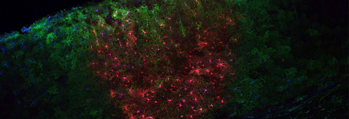 A slice of mouse visual cortex shows cells labeled in blue, red and green