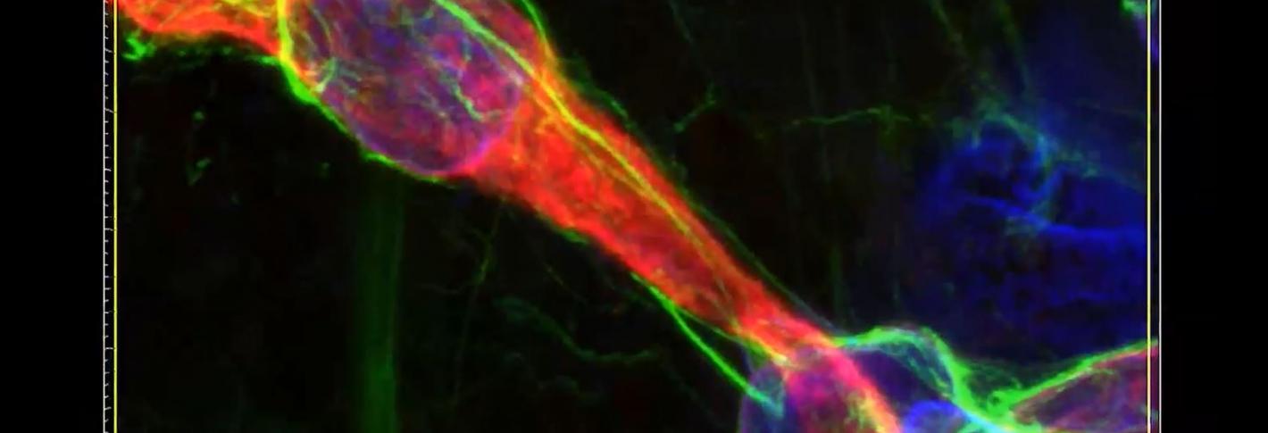 An image derived from MAP technology shows interaction between an astrocyte and endothelial tissue