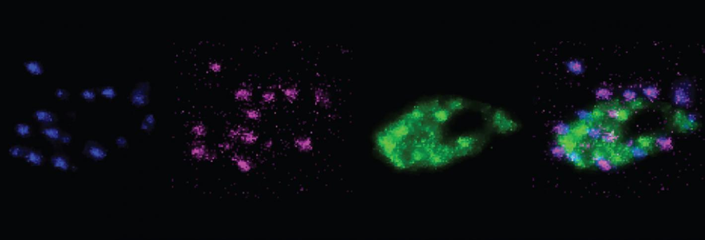 A sequence of four panels on a black background shows colorful labeling of proteins, which appear as blue, purpole and green splotches. The left three panels show them independently. The right hand panel shows them all together.