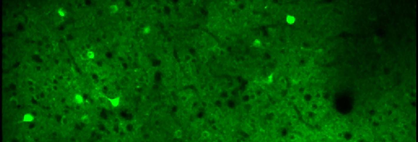 A few neurons flash bright green before a duller greenish background of brain tissue