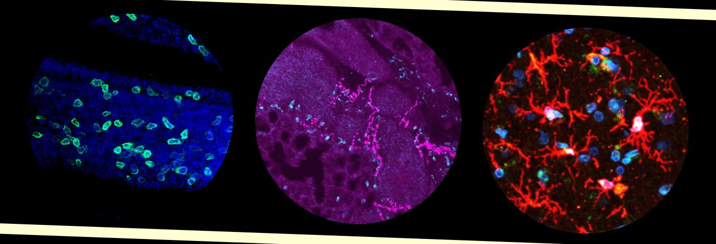 A horizontal arrangement of three circles on a black background and framed with pale yellow stripes show colorfully stained cells in tissues.