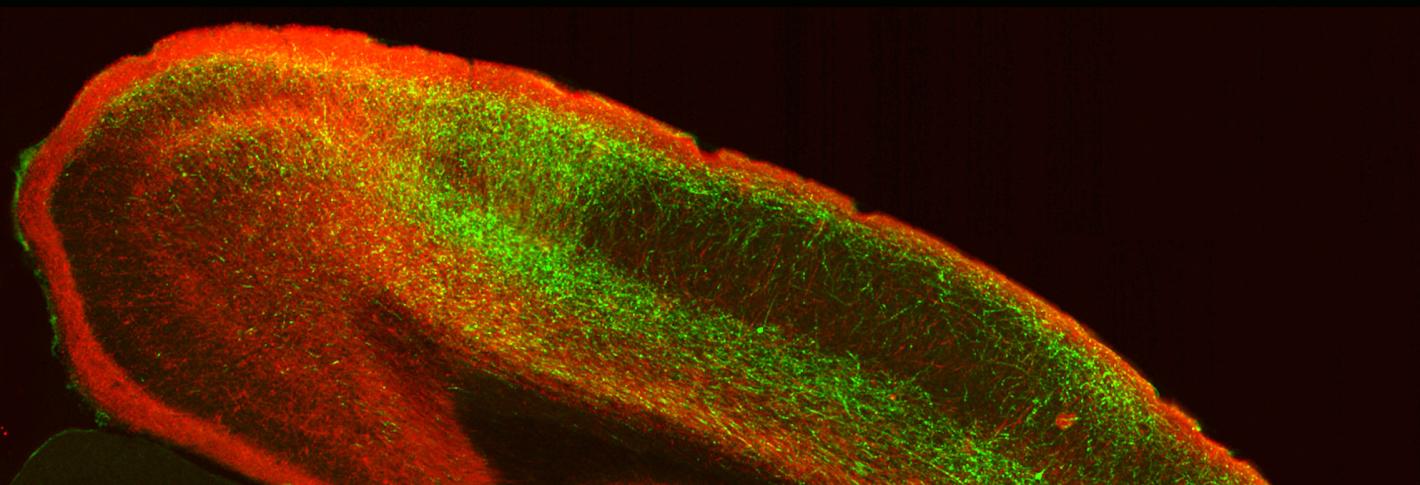 A view of the upper right quadrant of a cross section of a mouse brain. An arc of tissue extends from the top left to the bottom right. Along the arc there are stripes of neurons glowing in eithe red or green in distinct layers of the tissue