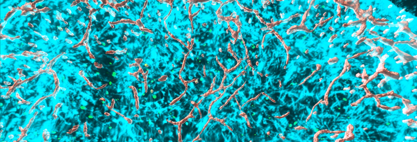 A closeup of the top of a circle made up of thousands of cyan neurons and many gray blood vessels winding throughout
