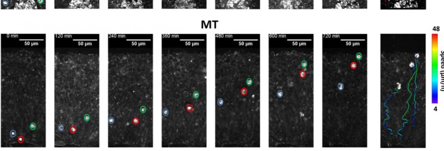 A series of columns in two rows tracks the trajectory of a few highlighted cells with colored lines trailing behind them. The lines behind the cells in the top row are straigther and more consistently red than the lines trailing behind the cells in the bottom row.