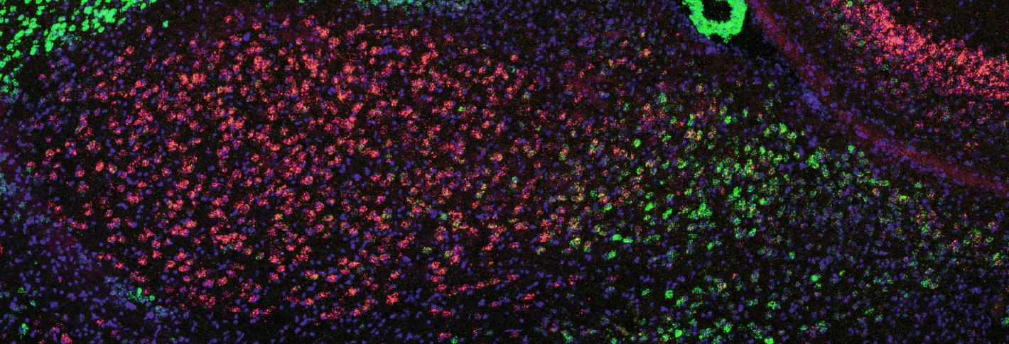 The almond shape of the amygdala is composed of cells stained red (on the left) and green (on the right).