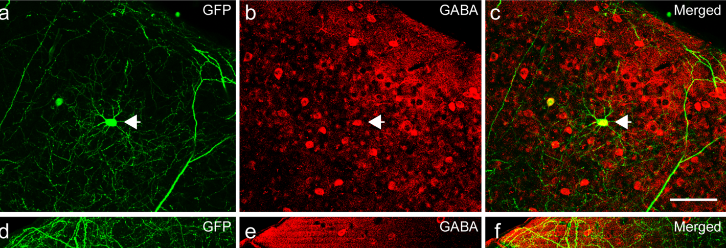 Six panels show neurons stained in green or red colors to inidicae the presence of GABA, an inhibitory neurotransmitter
