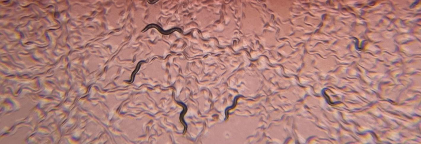 A microscope view of several worms wriggling through a red-hued gel