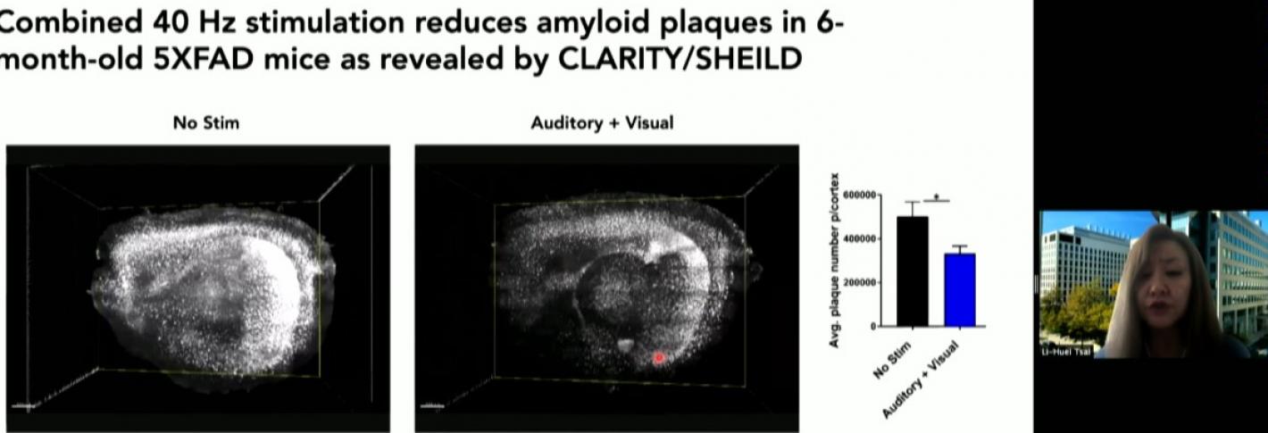 A Zoom screenshot shows Li-Huei Tsai presenting side by side brains showing different amoutns of amyloid plaque