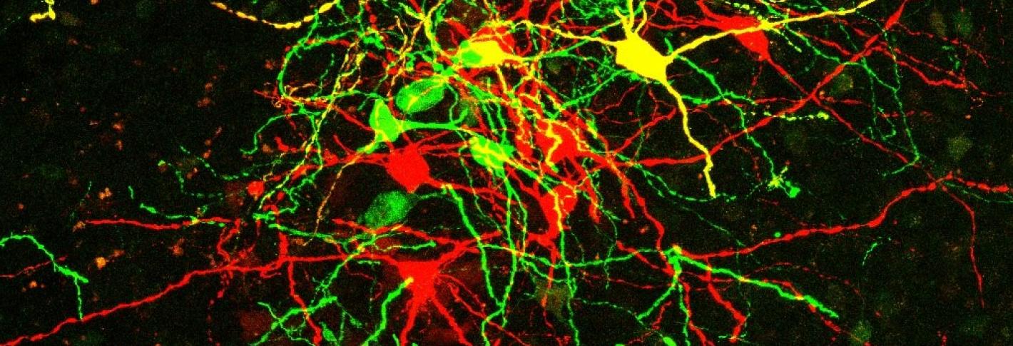 On a black background there is a tangle of red and green stained neurons
