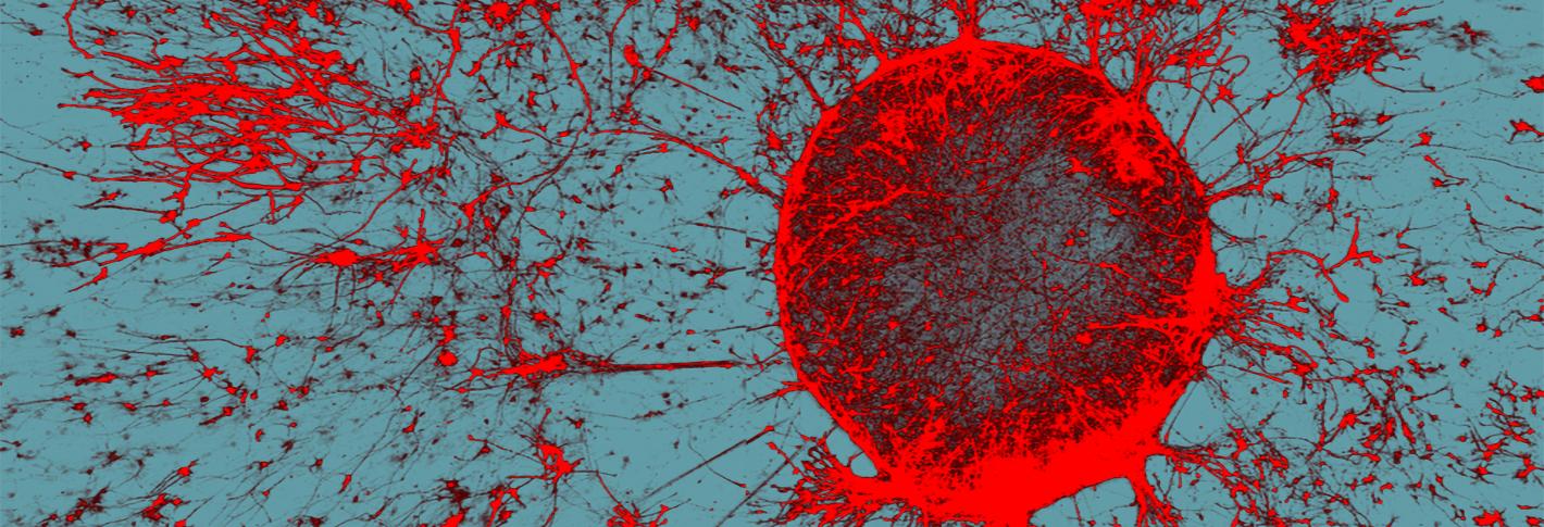 On a gray-blue background there is a circle made of bright-red stained neurons. The neurons radiate out from the circle edge, like solar flares, reaching across the image.