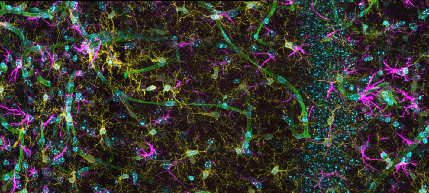 A beautiful view of hundreds of different brain cells stained in bright colors