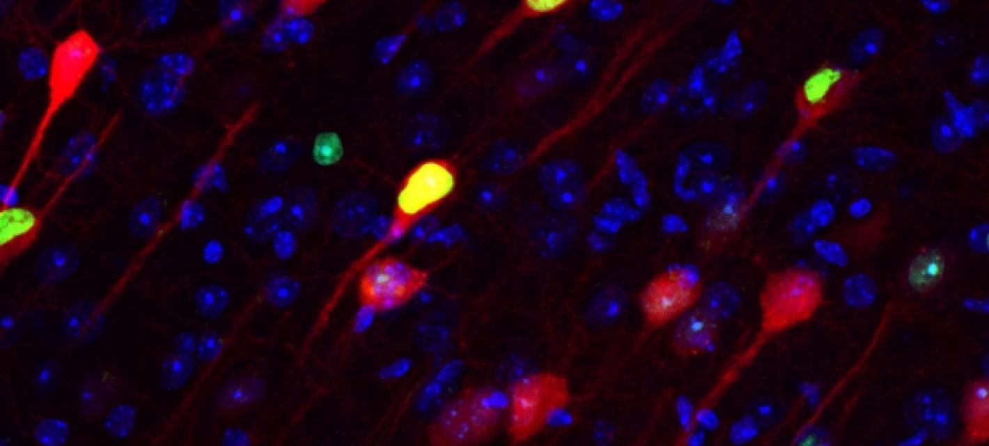Neurons stained green and red appear over a black background