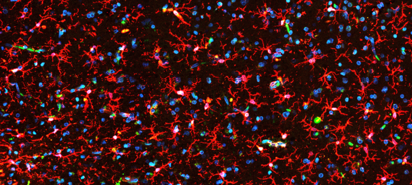 Hundreds of crab-shaped, red-stained microglia, accompanied by the blue-stained nuclei of neurons, cover the field of view against a black background.