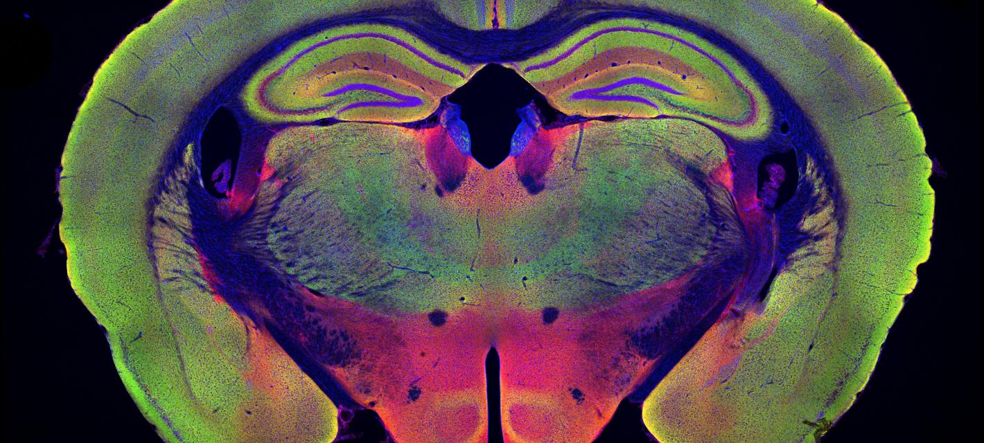 Color image of brain slice