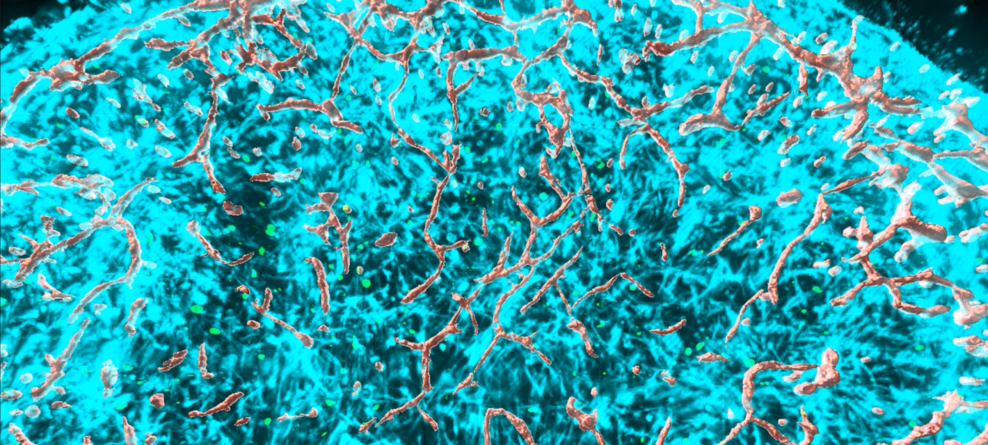 A closeup of the top of a circle made up of thousands of cyan neurons and many gray blood vessels winding throughout